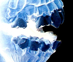 Zugfogászok Nagykanizsán Zugfogászok Nagykanizsán