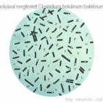 Clostridium botulinum nevű baktériumClostridiumbotulinum_bakterium
